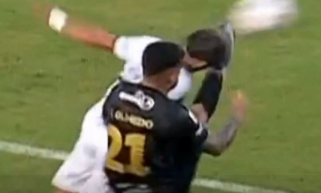 Elvio Vera queda con hematomas en el rostro tras la “patada” de Olmedo